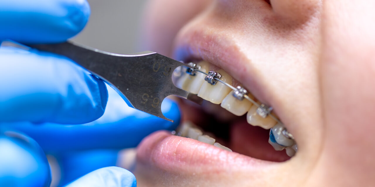 Top Benefits of Choosing an Experienced Orthodontist for Your Treatment