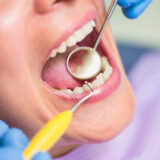 Tooth extraction