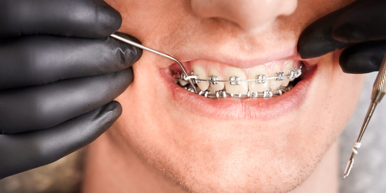 How an Orthodontist Can Correct Jaw Alignment and Improve Oral Health