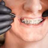 Orthodontist