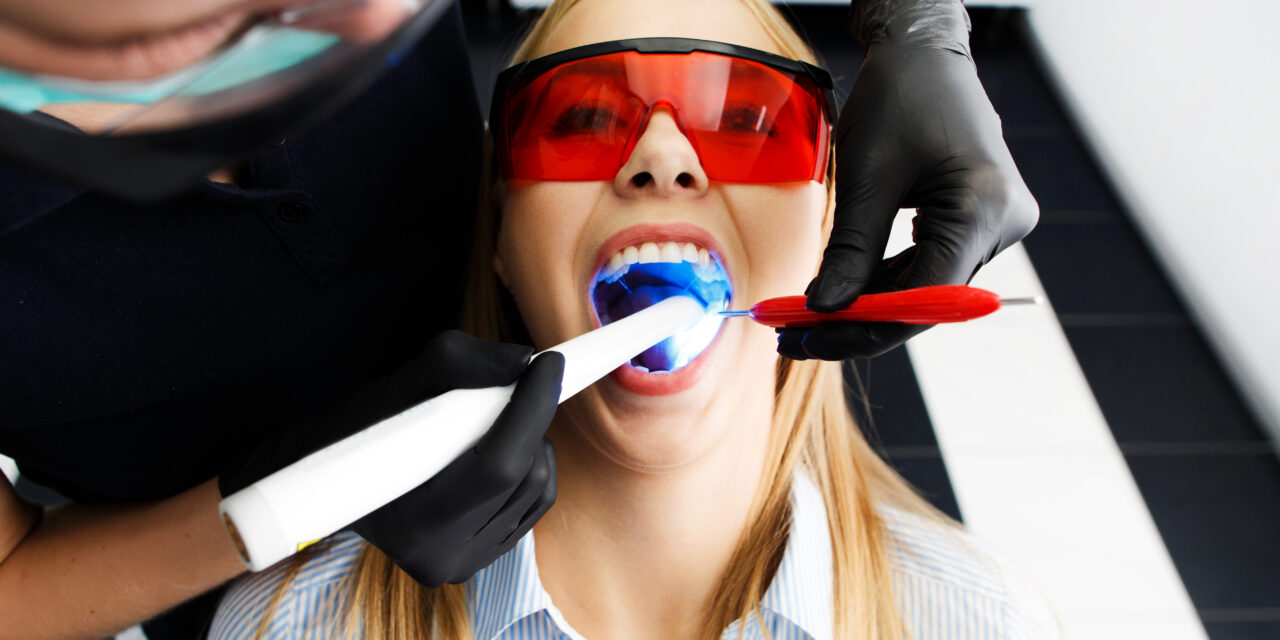 Dentist-Approved Teeth Whitening: What You Need to Know Before You Start